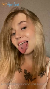 7192218