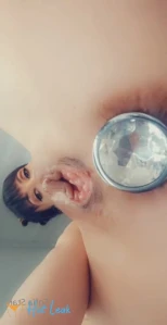 6876290