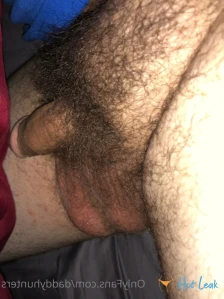 7143851