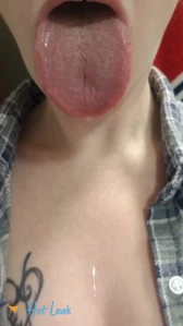 6635314