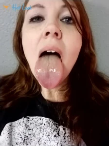 6635336