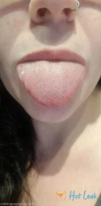 6771819