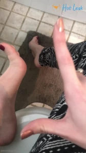 6634658