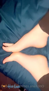 6629383