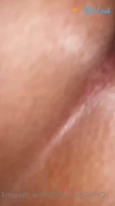 6541556