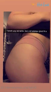 6518368