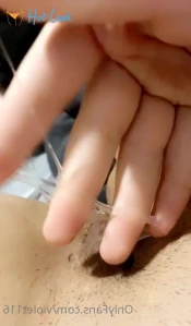 6518411