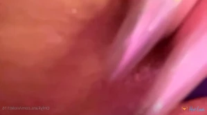 6518504