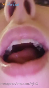 6513370