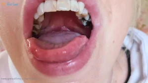 6513779