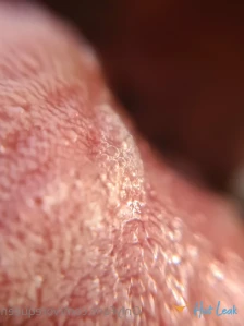6887646