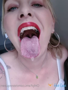 6887676
