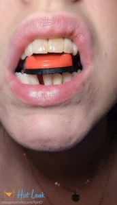 6887725