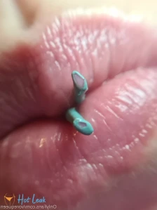 6887855