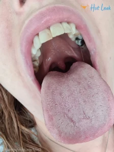 6887881