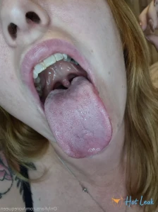 6887928