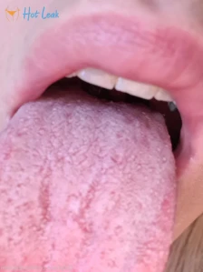 6887986