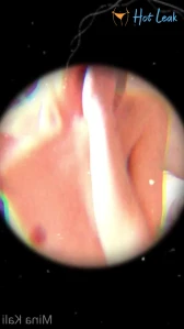 7844615