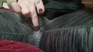 7796605