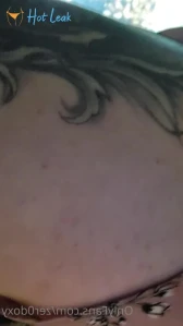7796641