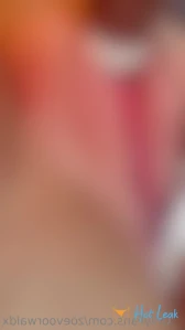 7796430