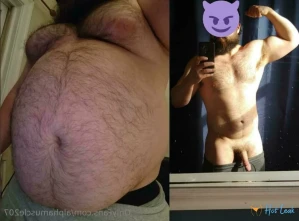 11284962