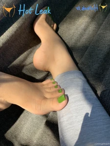 11834593