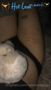 11817720