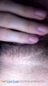8179345