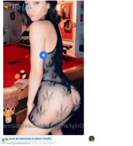9129296