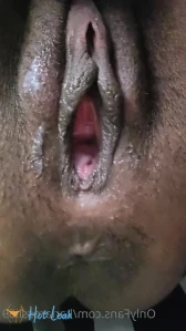 8158199