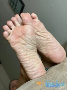 11635042
