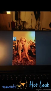 11862635
