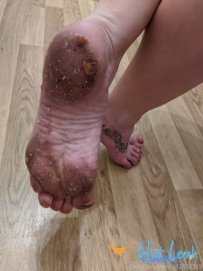 11522864