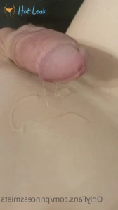 7992654