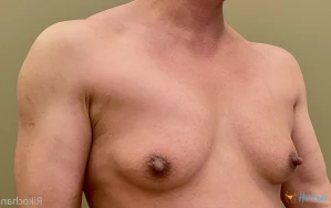 7908576