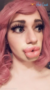 11176170
