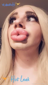 11730326