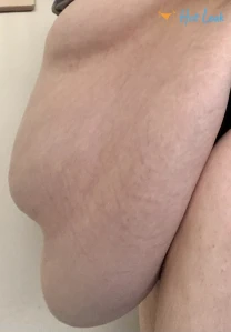 7873592