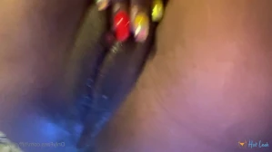 7936452