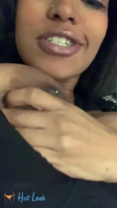 7935978