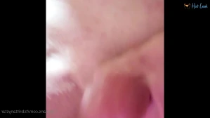 7931380