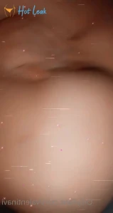7921431