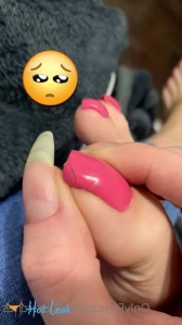 7913883