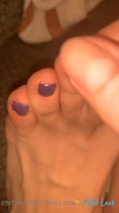 7913967