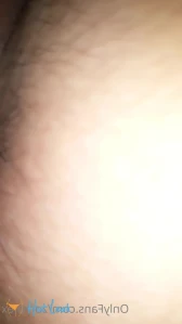 7904287