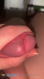 10399403
