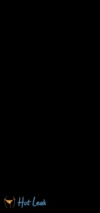 10392331