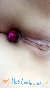 11839449