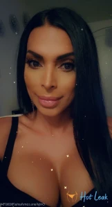10158281